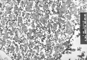 M, 8y. | ceroid-lipofuscinosis - brain